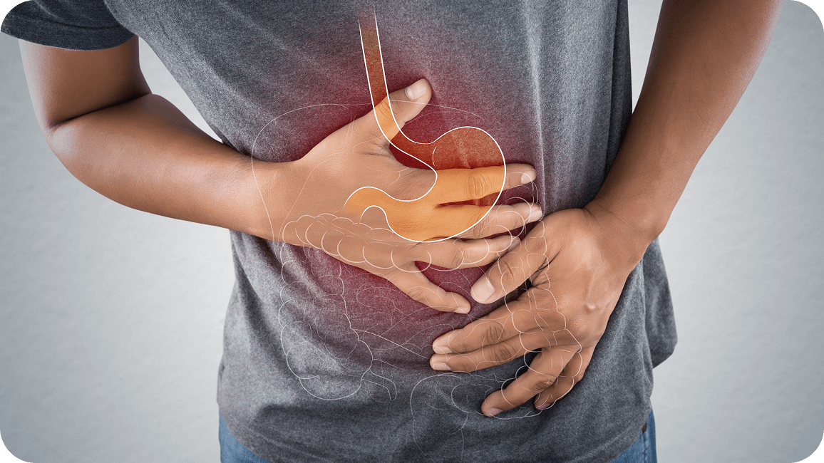 Doença de Crohn